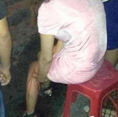 艾滋病患者数量变化 328288_6db11378428418e193c8163f68c5e.png